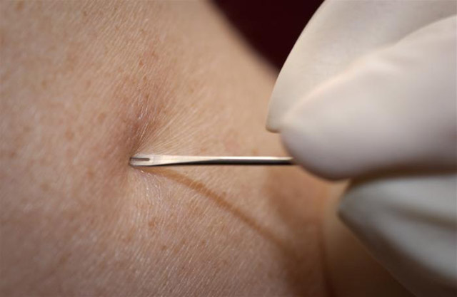 Bioterrorism Laboratory Testing