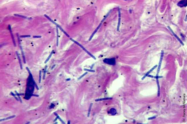 Bioterrorism Laboratory Testing