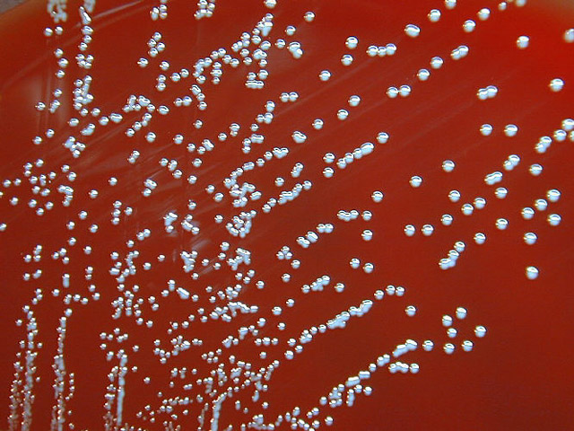 Bioterrorism Laboratory Testing