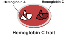 Hemoglobin C trait - red blood cell with hemoglobin types A and C