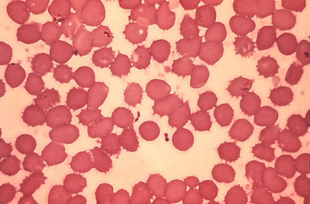 Bioterrorism Laboratory Testing